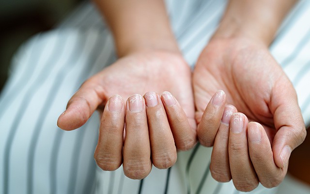 Zwei offene Hände mit kurzen, natürlichen Fingernägeln.